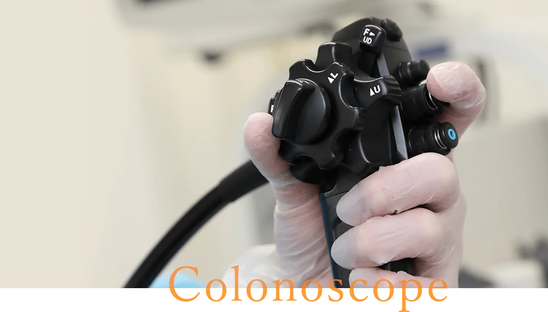 大腸カメラ（大腸内視鏡検査）